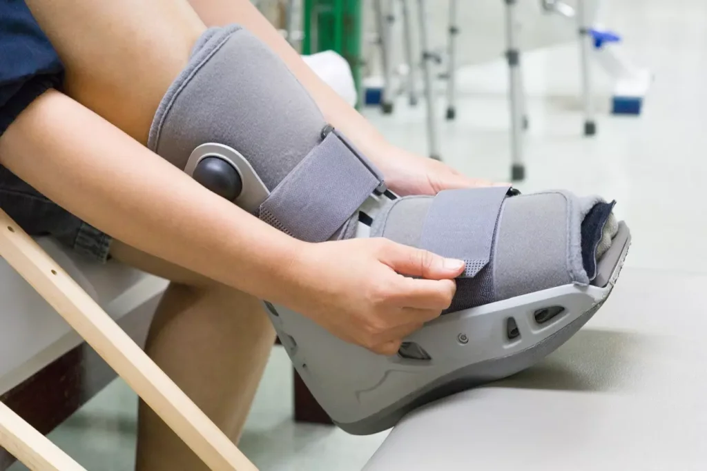 Post-Ankle Replacement